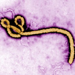 What You Need To Know About Ebola…
